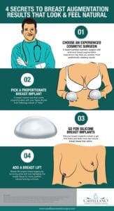 4 Secrets to Breast Implant Results That Look & Feel Natural [Infographic]