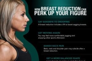 How Breast Reduction Can Perk Up Your Figure [Infographic]