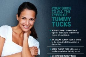 Infographic explaining the types of tummy tucks